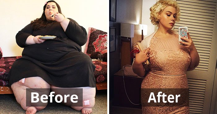 25 Before And After Photos Show Unbelievable Transformations From ‘600 Lb Life 