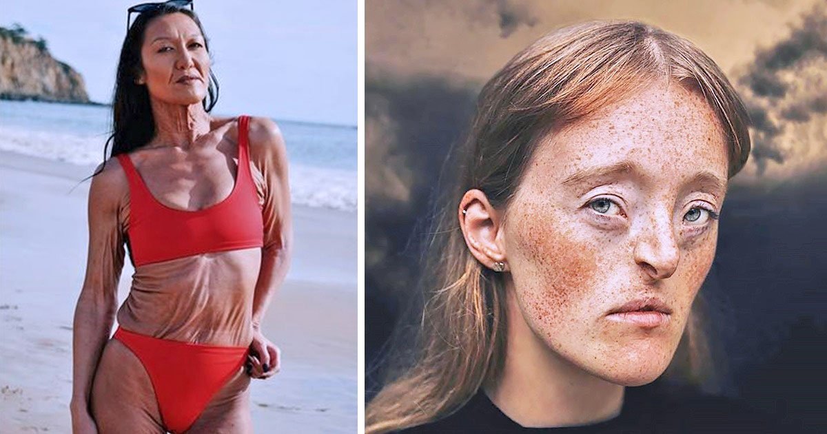 Unique Body Features You May Only See Once In A Lifetime
